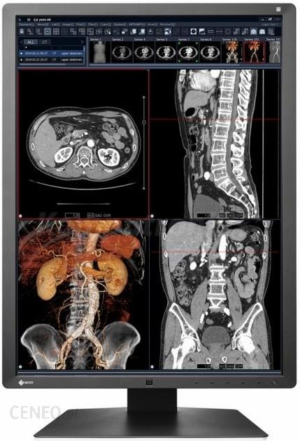 i-eizo-radiforce-rx250bk